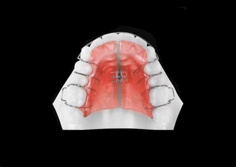 Poker Schwartz Dentes